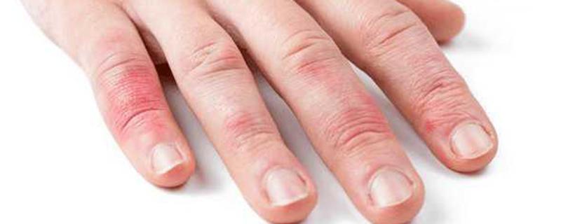 灰指甲穿过的鞋刷完可以穿吗 穿了灰指甲的人的鞋子怎么办