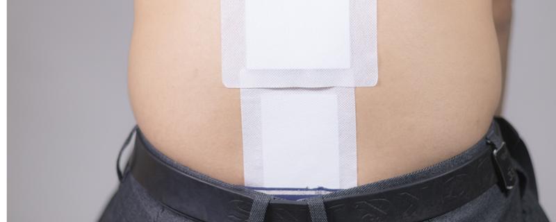 艾脐贴贴多久拿掉 艾脐贴几天贴一次比较好