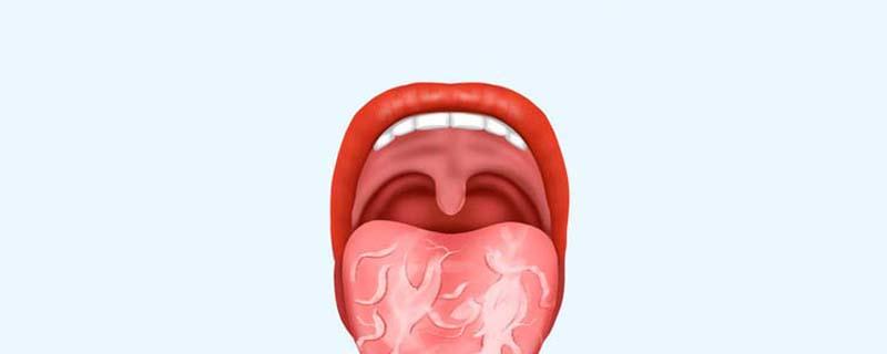 地图舌能喝酒吗 地图舌能喝牛奶吗