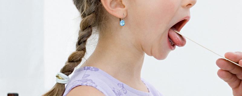 地图舌吃维生素b2管用吗 地图舌可以喝牛奶吗