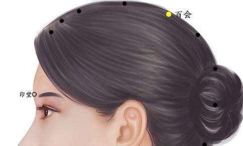 失眠针灸哪里最好 失眠针灸治疗方法