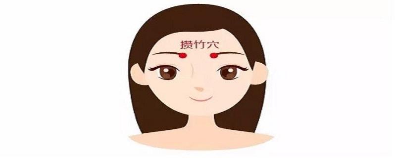 攒竹的针刺方法 针灸攒竹的功效