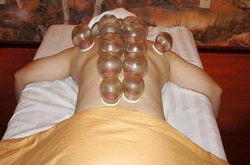 咳嗽拔罐部位图解 咳嗽拔火罐的位置图片