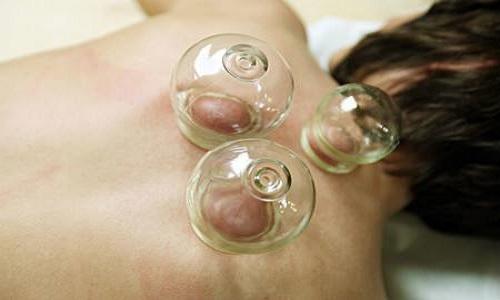 痤疮拔火罐有用吗 放血拔罐治疗痤疮