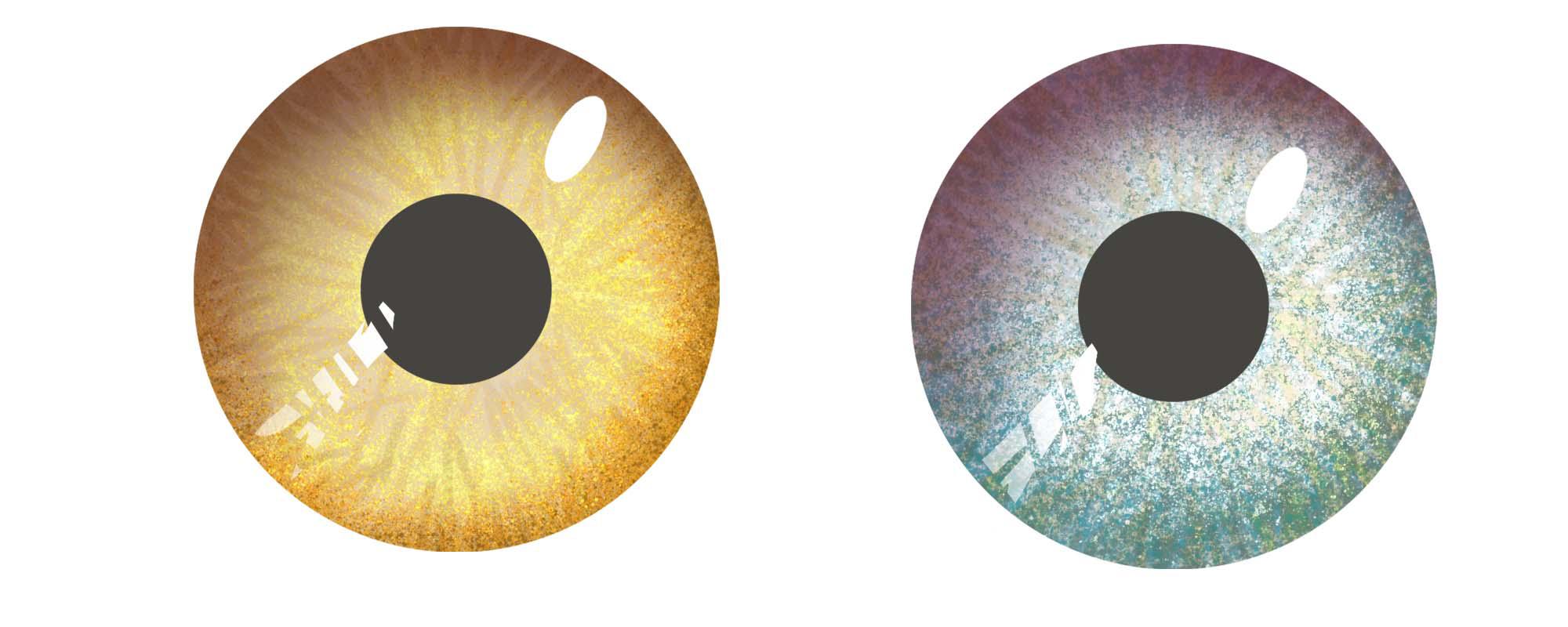 美瞳日抛月抛年抛哪个对眼睛最好 戴美瞳会加重近视吗