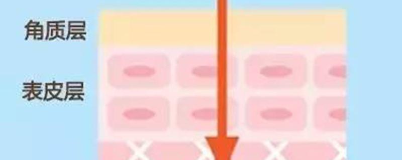 刷酸美白用哪种酸 手臂鸡皮肤可以刷酸吗