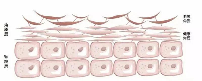 刷酸需要注意什么 刷酸要避免什么成分