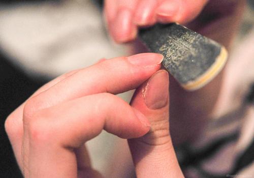 指甲缺营养变黄变厚吗 指甲变黄变厚怎么治疗