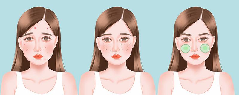 熬夜长斑会自行消失吗 熬夜长出来的是什么斑