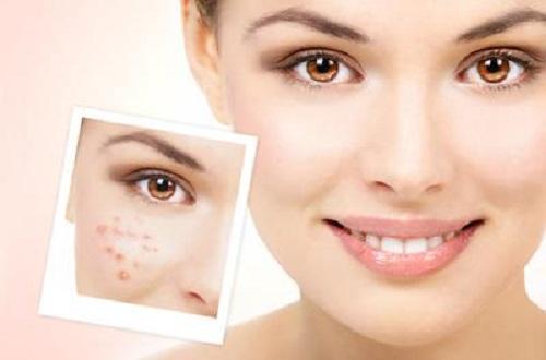 艾灸对痘痘有效果吗 长痘痘艾灸哪里