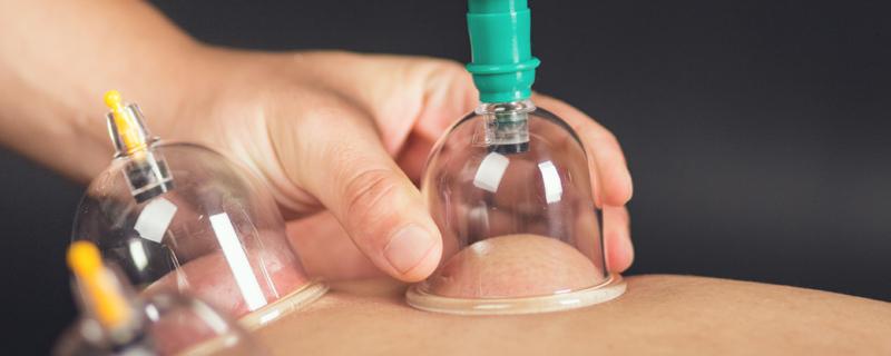 脚底拔罐的好处和坏处 涌泉拔罐可以天天拔吗