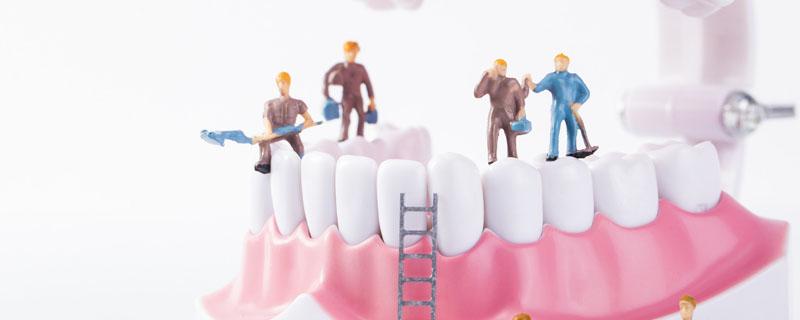 牙齿上有黑色的东西洗不掉怎么办 牙齿上有黑色的线条是什么