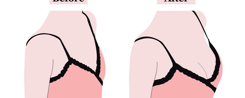 隆胸会爆炸吗 隆胸假体可以喂奶吗