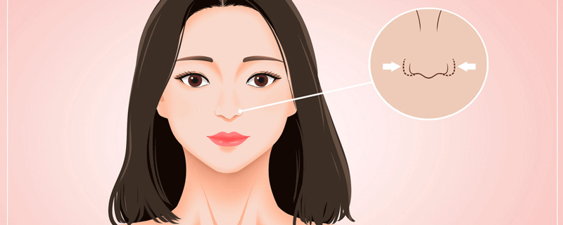 做鼻子手术有危险吗 做鼻综合手术风险大吗