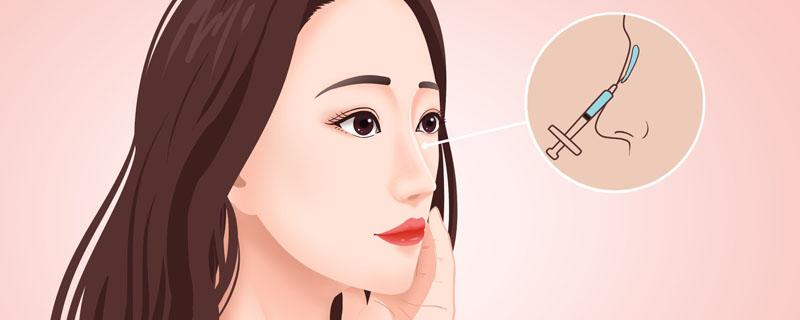 垫鼻梁用硅胶好还是膨体好 垫鼻梁可以用肋骨垫吗