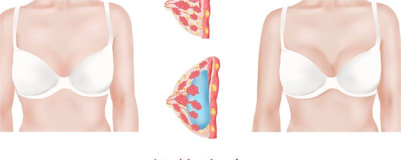 隆胸的手感和真的一样吗 隆胸后可以用力抓吗