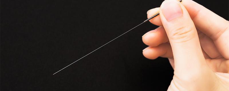 针灸对子宫的好处 宫寒针灸几次有效果